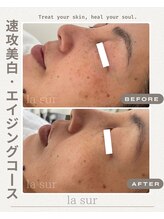 ラシュール(la sur)/