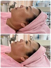 リアウェイク(Reawayke)/レモンボトルで小顔に