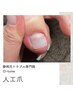 【人口爪】ハンドもフットも◎剥離している爪に長さを出します。￥4,400