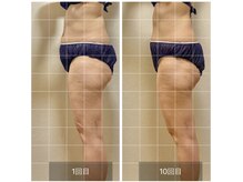 ルリアンデュレ(le lien durer)/回数券で、10回目の施術後