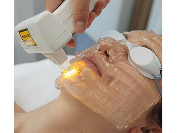 メディカルサロン フィオレ(fiore)の写真/毛穴洗浄＋光パワーライト照射(両頬)19800円→15840円この春、紫外線に負けない。毛穴から整う透明美肌へ