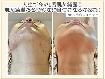 ポモナ 横浜馬車道店(Pomona)/シミや汚肌も変われます！