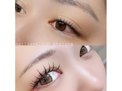 エトルナ(etoluna)の写真