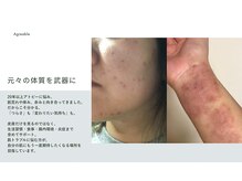アーブル(Agreable)/過去の私