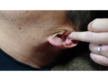 さくら/施術イメージ