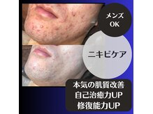 ハーブの力で人生最後のお肌改善☆自己治癒力・修復能力UP