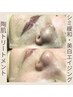 お試し【シミ改善/美白/ハリ艶UP】肌×骨格×筋膜ケアで年齢肌悩みを卒業♪