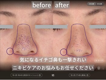 ダイヤモンドトゥルース(Diamond truth)/毛穴やニキビにもアプローチ