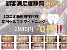 ホワイトニングショップ 静岡葵区店