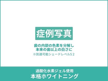 クレア(Crea)/【症例写真のご紹介】