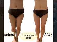 ヨサパーク ナナ リシェス(YOSA PARK nana Richesse)の雰囲気（たった1度でこの変化★ くびれと太ももが全然ちがう！！）