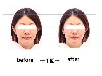 オール バイ ワンネス(ALL by One'Ness)/顔肉、むくみも即効小顔◎