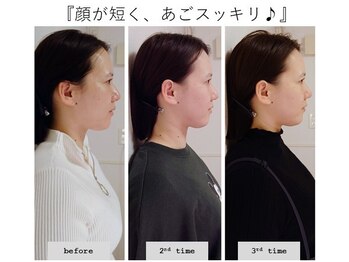 エピファニー(Epiphany)/頭が軽く、姿勢もよくなりました