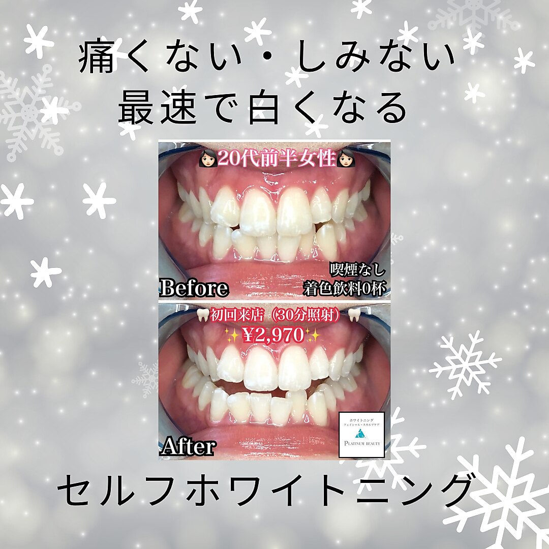 ホワイトニングビューティ 三川店｜ホットペッパービューティー