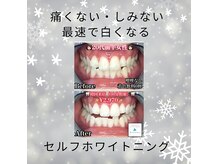 ホワイトニングビューティ 三川店