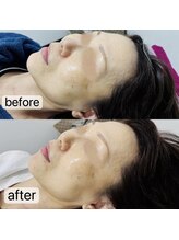 トゥインクル(Twinkle)/キュっと引き締め！