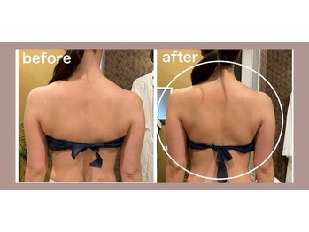 プリマヴェーラ(PRIMAVERA)/引き締まった背中&二の腕