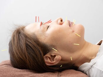 たかさきひかり鍼灸整骨院の写真/ほうれい線・たるみ改善に美容鍼◎40代のお顔悩みを解消し小顔リフトアップへ！美容鍼￥3,980円から！
