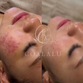 コアラル 恵比寿(COALALU)