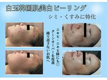 スパイア(SPIRE)の雰囲気(個室完備★たるんだ皮膚もしっかり引き締め!綺麗にサイズダウン)