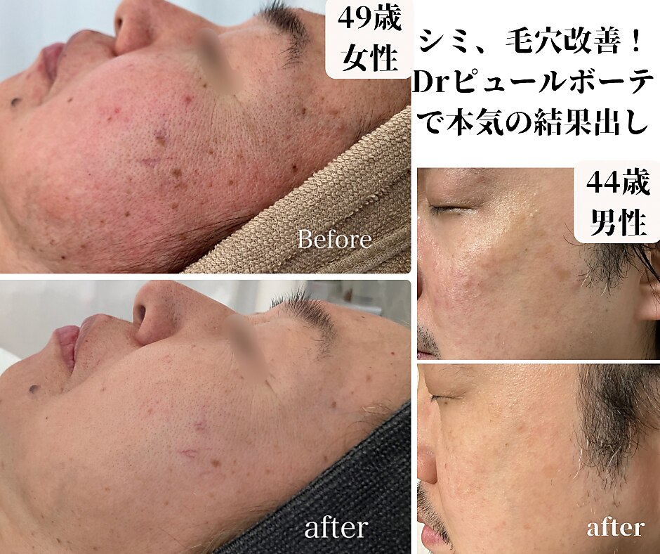 松阪市でEMSが人気のエステサロン｜ホットペッパービューティー