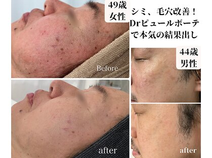 カラン(CALIN)の写真