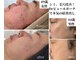 カラン(CALIN)の写真