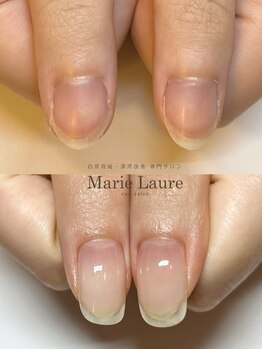 マリーロール 梅田店(Marie Laure)/自爪育成/深爪矯正/ネイルケア