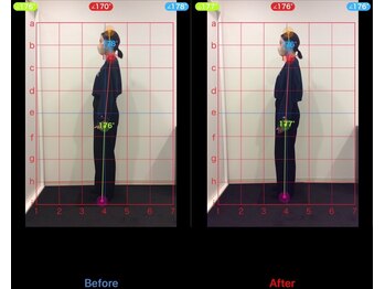 ケアルーム 茅ヶ崎(CAREroom)/施術効果写真☆(before after)