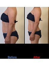 サロン シエラ/施術1回　60代