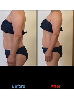 サロン シエラ/施術1回　60代