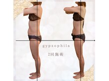 ジプソフィラ(Gypsophila)