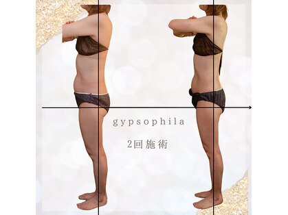 ジプソフィラ(Gypsophila)の写真