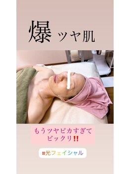 顔凛(カオリン)/ツヤ肌になる光フェイシャル