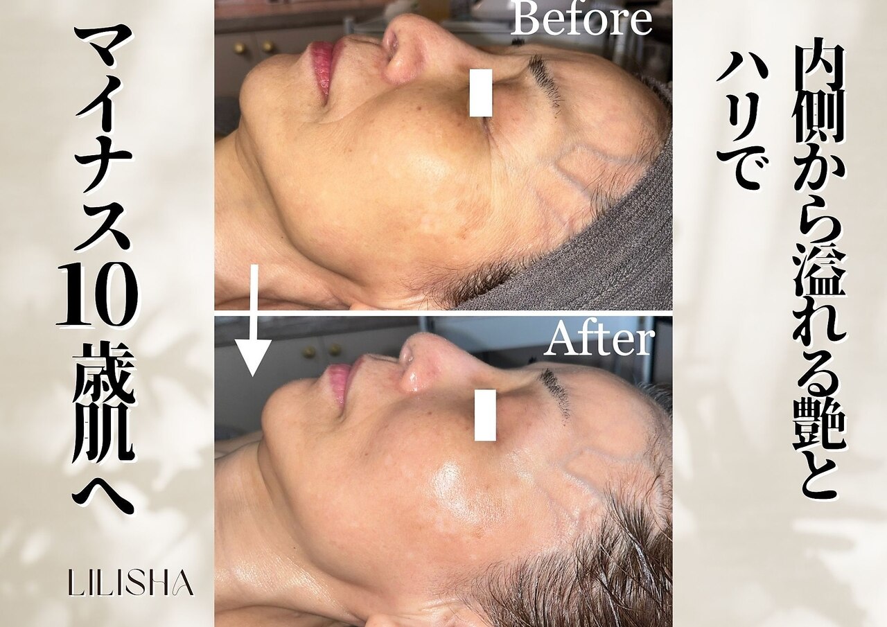 LILISHA 赤坂 ギャラリー 2