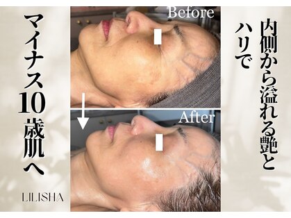 リリーシャ 赤坂(LILISHA)の写真