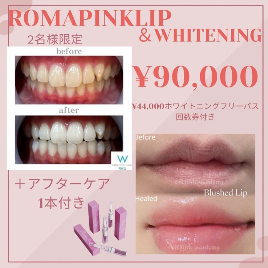 ホワイトニングショップ 町田店｜ホットペッパービューティー