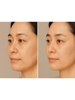 小顔になりたい