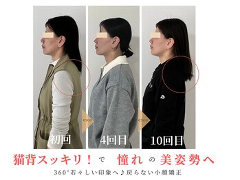 エソア(esoa)/40代 小顔矯正