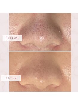 ベベ 福井丸岡店(Be'be')/モイストプレミアム