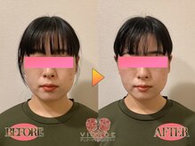 ヴィオーデ 弘前店/小顔、リンパ、ヘッドスパ、整体