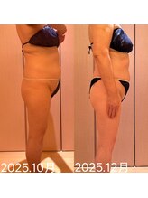 凪 横浜/関節の違和感も感じ無くなった。