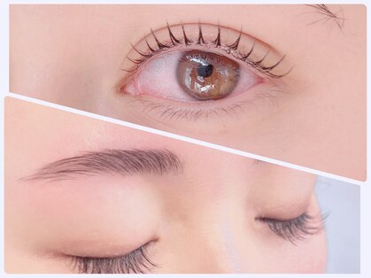 イアラ(era.)の写真