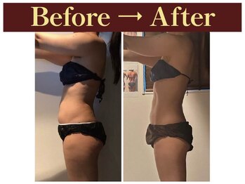 グレースフルタイム プレミアム(Graceful Time PREMIUM)/ビフォーアフター