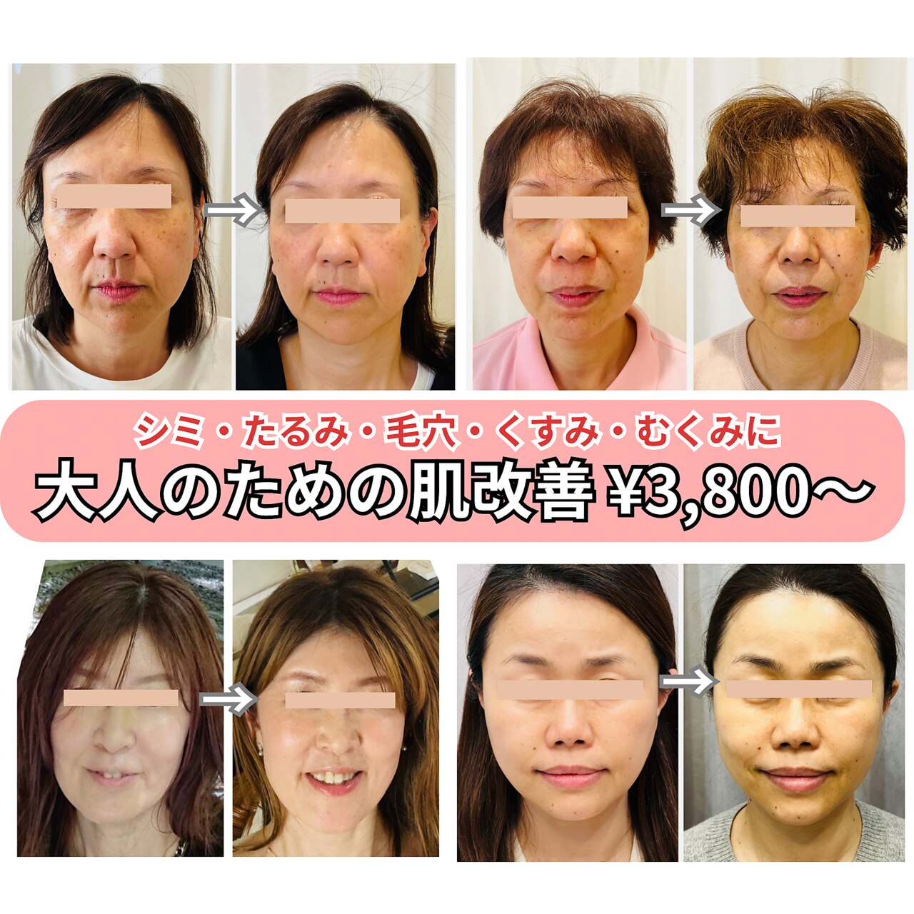 広島県でEMSが人気のエステサロン｜ホットペッパービューティー