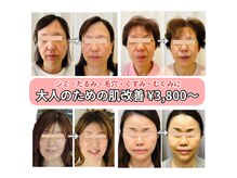 キュララ(KYURARA)