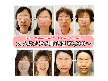 キュララ(KYURARA)の写真