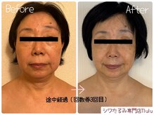 トルル(Tlulu)の雰囲気(【Before After】筋骨矯正エイジングケア。痛みないハンド技術。)