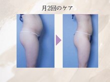ビーホープ(B.hope)の雰囲気（サイズダウンだけでなく、ハリのあるボディラインを目指します。）