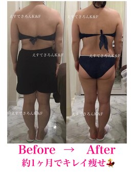 えすてさろん ケイアンドエフ(k&f)/施術結果5回/30代